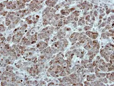Anti-TID1 antibody [N3C3] used in IHC (Paraffin sections) (IHC-P). GTX111077