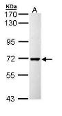 Anti-PPIL2 antibody used in Western Blot (WB). GTX111086