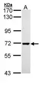 Anti-PPIL2 antibody used in Western Blot (WB). GTX111086