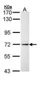 Anti-IL1 Receptor 1 antibody [C1C3] used in Western Blot (WB). GTX111092
