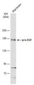 Anti-pro-EGF antibody [N3C1], Internal used in Western Blot (WB). GTX111099