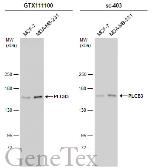 Anti-PLCB3 antibody used in Western Blot (WB). GTX111100