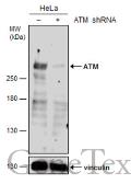 Anti-ATM antibody used in Western Blot (WB). GTX111106