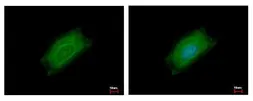Anti-Cyclin B2 antibody used in Immunocytochemistry/ Immunofluorescence (ICC/IF). GTX111118