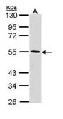 Anti-HIPPI antibody [N1C3] used in Western Blot (WB). GTX111124