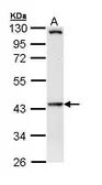 Anti-HIPPI antibody [C1C3] used in Western Blot (WB). GTX111125