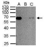 Anti-SMAD2 antibody used in Immunoprecipitation (IP). GTX111131
