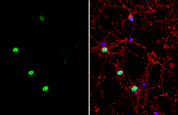 Anti-MEF2C antibody used in Immunocytochemistry/ Immunofluorescence (ICC/IF). GTX111134