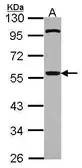 Anti-CDC20 antibody used in Western Blot (WB). GTX111137