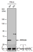 Anti-PPP3CB antibody [N1N3] used in Western Blot (WB). GTX111141