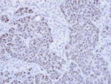Anti-PPIL2 antibody [N1C1] used in IHC (Paraffin sections) (IHC-P). GTX111142