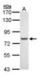 Anti-DDX41 antibody used in Western Blot (WB). GTX111146