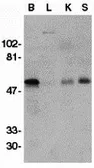 Anti-GDNF Receptor alpha 1 antibody used in Western Blot (WB). GTX11115