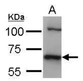 Anti-HSC70 antibody [C1C3] used in Western Blot (WB). GTX111150