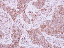 Anti-EEF1D antibody used in IHC (Paraffin sections) (IHC-P). GTX111151