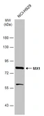 Anti-MX1 antibody used in Western Blot (WB). GTX111153