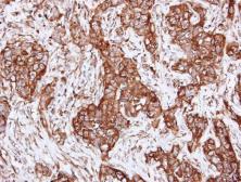 Anti-alpha Actinin 2 antibody [N2C1], Internal used in IHC (Paraffin sections) (IHC-P). GTX111167
