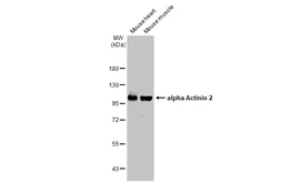 Anti-alpha Actinin 2 antibody [N2C1], Internal used in Western Blot (WB). GTX111167