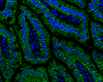 Anti-alpha Catenin antibody [N1N3] used in IHC (Paraffin sections) (IHC-P). GTX111168