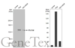 Anti-PLCG2 antibody used in Western Blot (WB). GTX111178