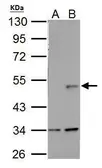Anti-Wnt1 antibody used in Western Blot (WB). GTX111182