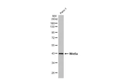 Anti-Wnt5a antibody used in Western Blot (WB). GTX111187