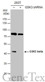 Anti-GSK3 beta antibody [C1C3] used in Western Blot (WB). GTX111192