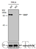 Anti-XIAP antibody used in Western Blot (WB). GTX111202