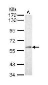 Anti-PRP19 antibody used in Western Blot (WB). GTX111205