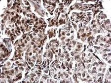 Anti-Calcineurin A antibody used in IHC (Paraffin sections) (IHC-P). GTX111207