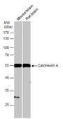 Anti-Calcineurin A antibody used in Western Blot (WB). GTX111207