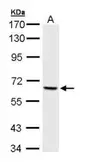 Anti-PAK1 antibody used in Western Blot (WB). GTX111208