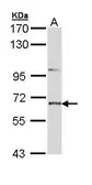 Anti-STEP / PTPN5 antibody [C1C3] used in Western Blot (WB). GTX111209