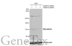 Anti-CARD10 antibody [N2C1], Internal used in Western Blot (WB). GTX111222