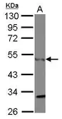 Anti-CtBP1 antibody [N2C2], Internal used in Western Blot (WB). GTX111229