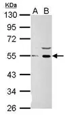 Anti-Wnt1 antibody used in Western Blot (WB). GTX111231