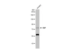 Anti-RIP antibody [C1C3] used in Western Blot (WB). GTX111235
