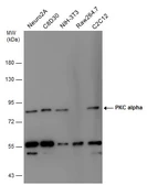 Anti-PKC alpha antibody used in Western Blot (WB). GTX111252
