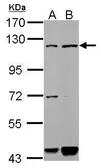 Anti-GAB1 antibody used in Western Blot (WB). GTX111253