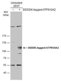 Anti-ATP6V0A2 antibody [N1N3] used in Western Blot (WB). GTX111275