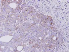 Anti-Her4 / ErbB4 antibody [C1C3] used in IHC (Paraffin sections) (IHC-P). GTX111276