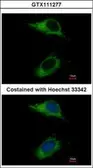 Anti-CARD6 antibody [C1C3] used in Immunocytochemistry/ Immunofluorescence (ICC/IF). GTX111277