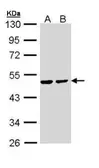 Anti-PPM1A antibody used in Western Blot (WB). GTX111288
