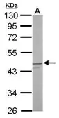 Anti-DUSP6 antibody [N2C3] used in Western Blot (WB). GTX111292