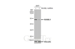 Anti-RUVBL1 antibody used in Western Blot (WB). GTX111294