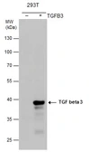 Anti-TGF beta 3 antibody [N1C1] used in Western Blot (WB). GTX111296