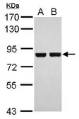 Anti-RSK2 antibody used in Western Blot (WB). GTX111302