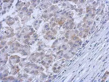 Anti-c-Abl antibody used in IHC (Paraffin sections) (IHC-P). GTX111317