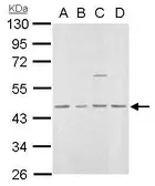 Anti-MVD antibody used in Western Blot (WB). GTX111324