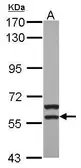 Anti-MATK antibody [N3C3] used in Western Blot (WB). GTX111326